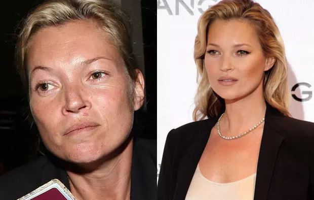 Kate Moss sans maquillage