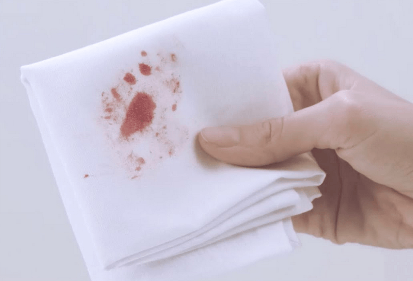 Comment enlever une tâche de sang sec sur un jean ?