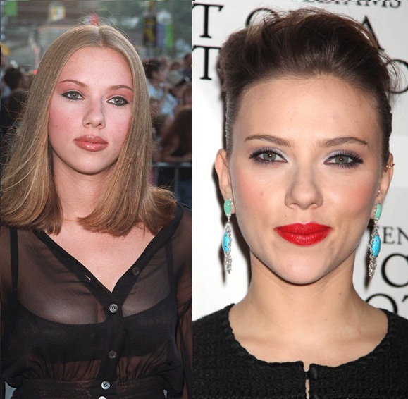 Aujourd'hui Scarlett Johansson est l'une des actrices les plus belles et les plus sexy de la planète. Mais avant d'en arriver là, la jeune femme est passée par la case chirurgie pour une petite rhinoplastie en vue d'affiner son nez.