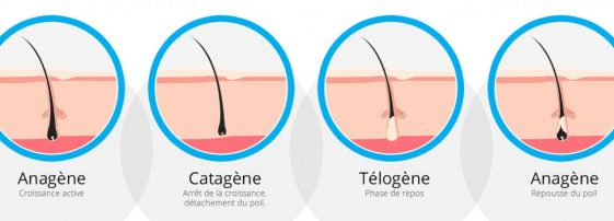 Poil incarné : Comment se débarrasser de ce problème gênant (Causes et ...