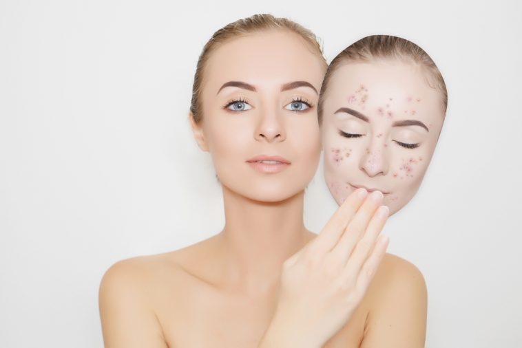 Peeling Visage Tout Ce Qu Il Faut Savoir Sur Le Prix Types Et Techniques Du Peeling