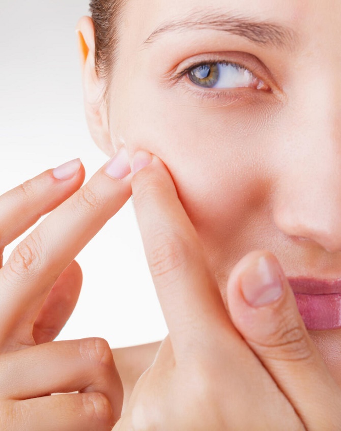 5 erreurs que nous commettons lorsque nous prenons soin de l'acné 3